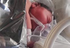 Hayati tehlikesi bulunan bebeğe polis helikopteriyle sevk