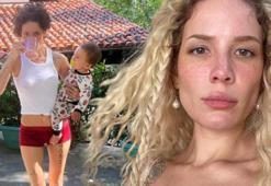 Halsey hastaneden paylaştı: Her şeye alerjim var!