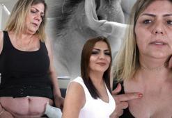 Güzelleşmek istedi sağlığından oldu! 'Vücudum haritaya döndü'