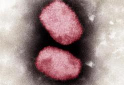 Maymun çiçeği virüsü üç ülkede daha görüldü