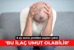 6 ay sonra yeniden saçları çıktı! 'Bu ilaç umut olabilir'