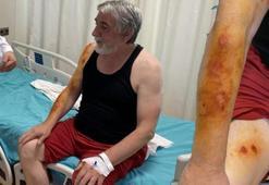 Lavabo açıcı bomba gibi patladı! Soluğu hastanede aldı
