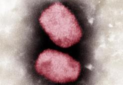 Maymun çiçeği virüsü Macaristan'a sıçradı
