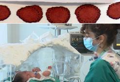 Komplo teorileri nedeniyle aileler topuk kanı taramasını reddediyor