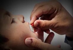 2013’ten bu yana ilk kez oluyor! ABD’de çocuk felci vakası