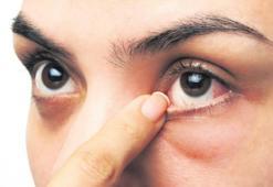 Göz kuruluğuna dikkat!