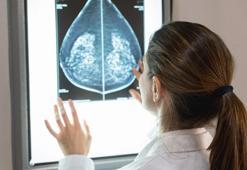 Meme kanserinde beslenme şekli hastalığı yavaşlatıyor