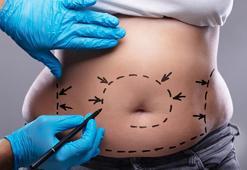 'Karın estetiği ve yağ aldırma bir zayıflama yöntemi değil'