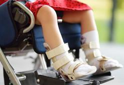 Serebral Palsi hakkında bilinmesi gereken 3 önemli nokta