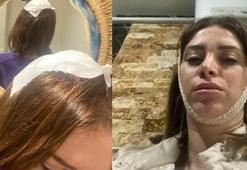 Yaşadığı dehşeti böyle anlattı! 'Korku filmi izlerken korku dolu anlar başladı'