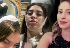 Ev basıp, eşini tabanca kabzasıyla darbeden müteahhit, teslim oldu