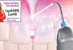 Hızlandırılmış ortodontik tedaviler