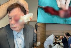 '15 gün yaşamaz’ denildi, Türk doktorlar inanılmazı başardı! 'Yaşaması için tek şansı buydu'