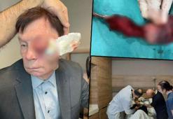 '15 gün yaşamaz’ denildi, Türk doktorlar inanılmazı başardı!
