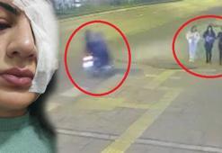 Üniversiteli kızlara içi su dolu balon atan şahıslardan şoke eden savunma