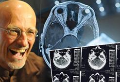 İtalyan cerrah tıp dünyasını karıştırdı! 'Kadavradan beyin nakli yapmanın bir yolu var'