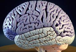 İtalyan doktordan beyin nakli açıklaması! Tek bir şart sunarak herkesi şaşkına çevirdi