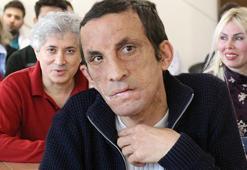 Türkiye’nin ilk yüz nakli! Uğur Acar 11'inci yılını kutladı