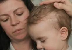 Tekirdağ'da doğum esnasında dehşet! Doktor bebeğin başını neşterle kesti