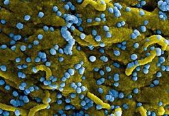 Tedavisi yok! Marburg virüsünden ilk ölüm haberleri geldi, sınırlar kapanıyor