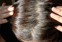 Erken yaşta saçların beyazlamasını engellemenin 4 püf noktası