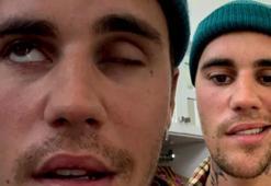 Ramsay Hunt sendromuna yakalanmıştı! Justin Bieber dünya turnesini iptal etti