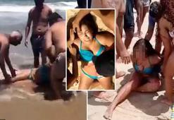 Bir gün arayla 2. saldırı! Birinin bacağını, diğerinin kolunu tek ısırıkta kopardı