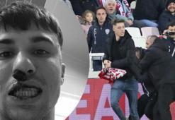 Sivas taraftarının burnunu kırdığı Bianco ameliyat olacak!