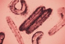 Tedavisi ve aşısı olmayan virüs: Marburg! Bulaştığı kişi 9 günde ölüyor