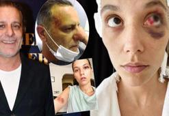 Ozan Güven'den Deniz Bulutsuz açıklaması: Yakında hepsi bitecek