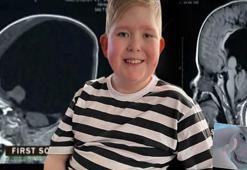 MR baktıklarında adeta beyni yoktu! Bir sandviçi tek başına yemesi 2 yılını alsa da başardı