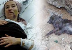 Yaşadığı kabusu anlattı: Kurt önce yüzümü ısırdı