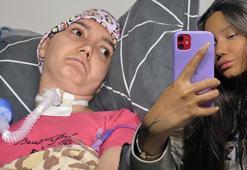 Dilara’nın 2 yıl sonra evinde ilk bayramı! En büyük hayali eski sağlığına kavuşmak