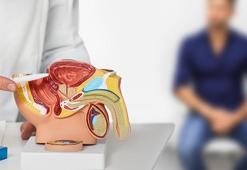 Prostat kanserinde yeni nesil tedavi! Bu yöntem tümörü 12'den vuruyor