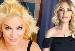 Estetik ameliyat olan Songül Karlı'nın son hali!