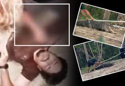 Kolu dirseğinden koptu! Hastanede söylediği tek söz infial yarattı