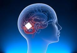 Elon Musk'ın beyin çipi şirketi Neuralink'e insanlı deney için onay