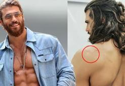 Can Yaman sırtındaki çizikleri paylaştı: Sabırsızlanıyorum