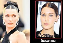 Yanaktan yağ aldırma uyarısı