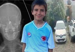 Başında mermiyle yaşam savaşı veren Kerem, erken doğan kardeşiyle aynı hastanede