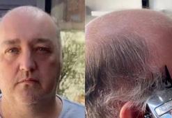 Berbere 42 yaşında girdi 28 yaşında çıktı! İnanılmaz değişim