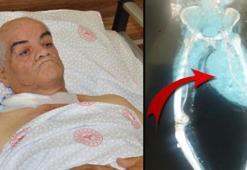 Ayakları ağrıdığı için hastaneye gitti, gerçeği öğrenince hemen ameliyat oldu