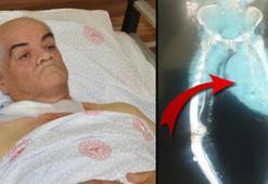 Ayakları ağrıdığı için hastaneye gitti, gerçeği öğrenince hemen ameliyat oldu