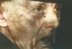 430 milyon kez hıçkıran adam! 68 yıl her yolu denedi, 1 günde kurtuldu