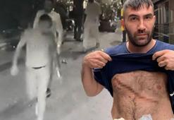 Gece kulübünde 'taciz' dehşeti! Defalarca bıçaklandı, 44 dikiş atıldı