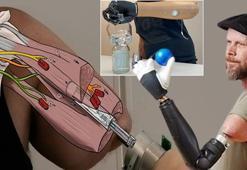 Zihniyle elindeki tüm parmakları kontrol edebiliyor! Adım adım nasıl biyonik adam oldu?