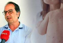 Prof. Dr. Şener: Kızamık  masum bir hastalık değil