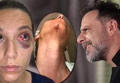 Ozan Güven - Deniz Bulutsuz davasında adli tıp raporu mahkemeye ulaştı!