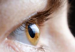 Gece araç kullanırken ışıklar gözünüzü alıyorsa bu hastalığa sahip olabilirsiniz!