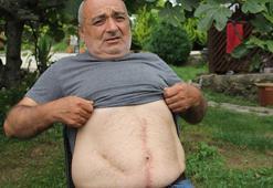 18 yıl boyunca karnında unutulan 3 parça gazlı bezle yaşadı
